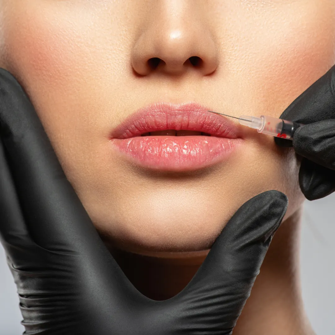 Sculptra procedure at MaxWell Aesthetics in Mission, KS