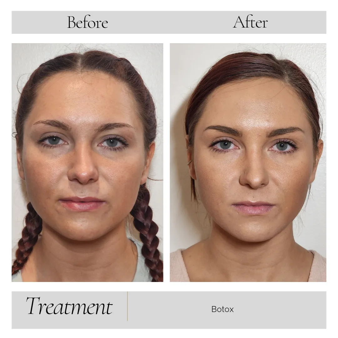 Facial Balancing in Kansas City, MO