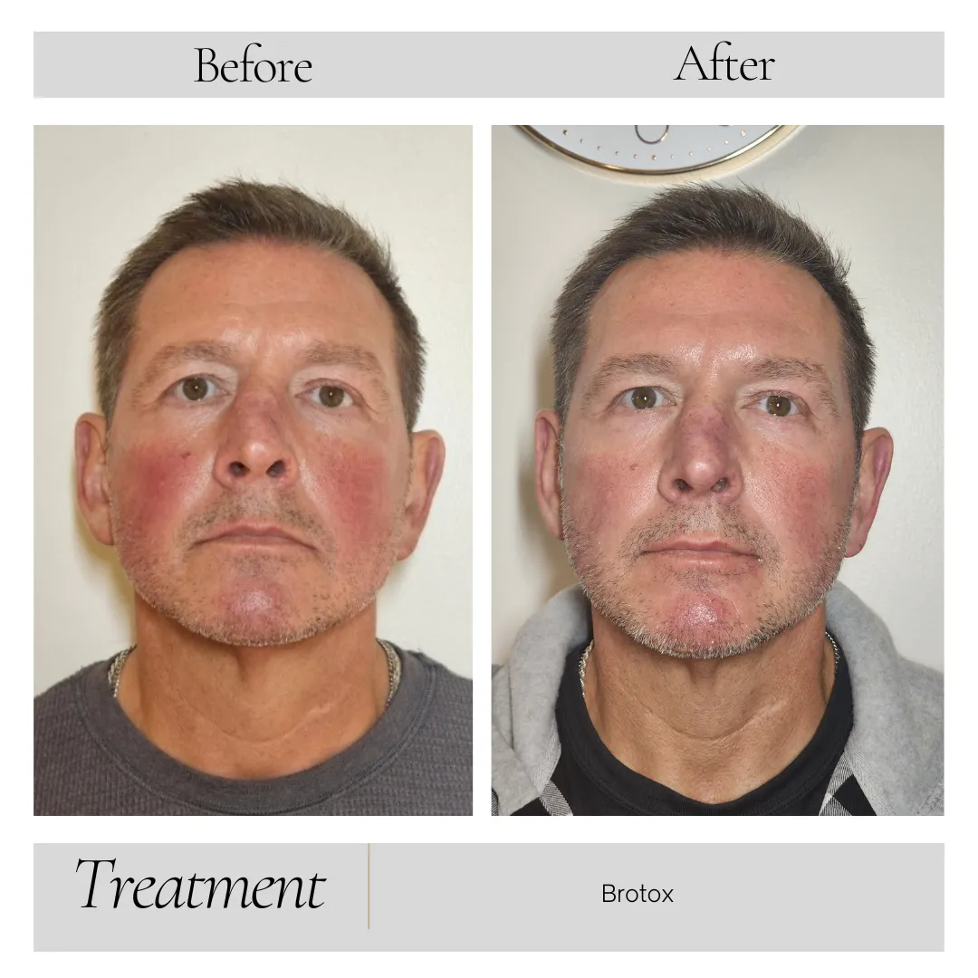 Facial Balancing in Kansas City, MO