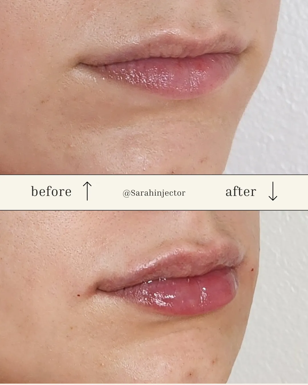 Facial Balancing in Kansas City, MO