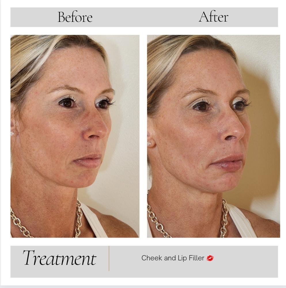 Facial Balancing in Kansas City, MO