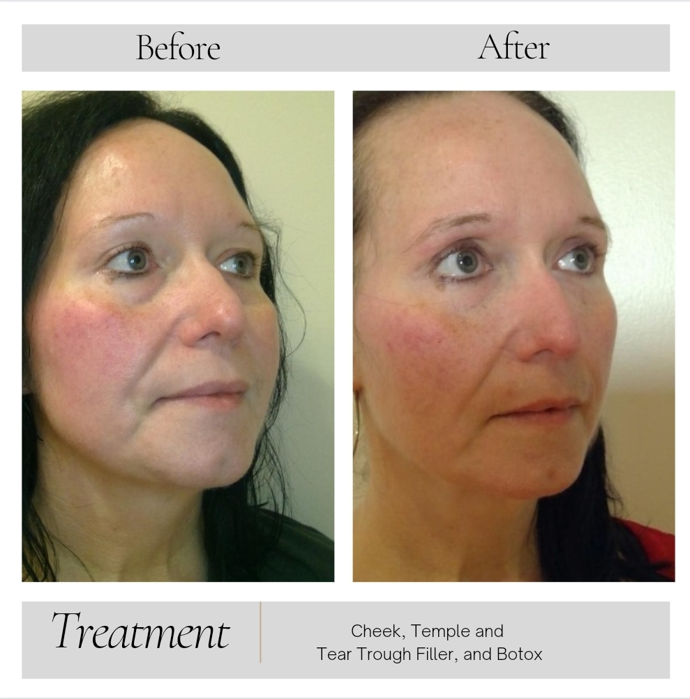 Facial Balancing in Kansas City, MO