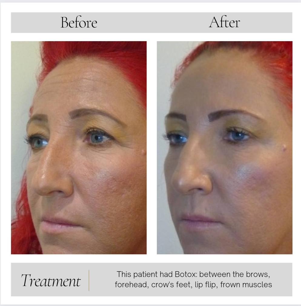 Facial Balancing in Kansas City, MO