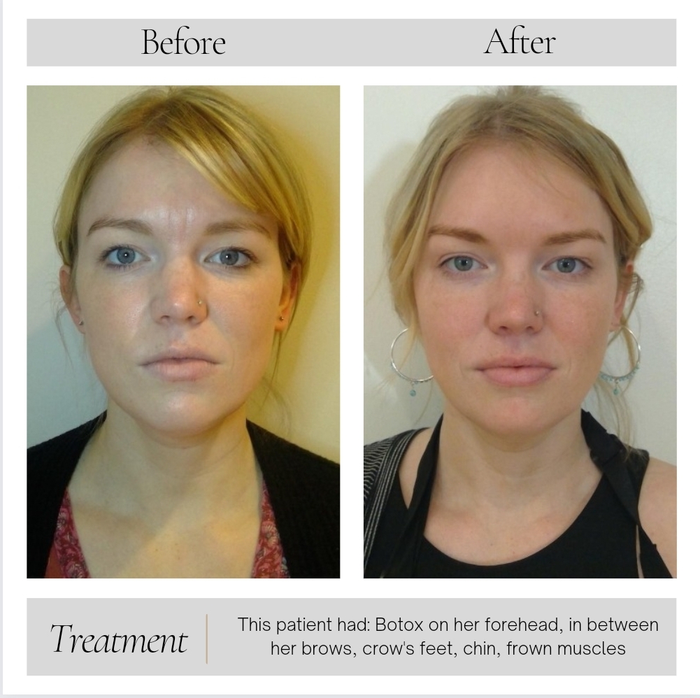 Facial Balancing in Kansas City, MO