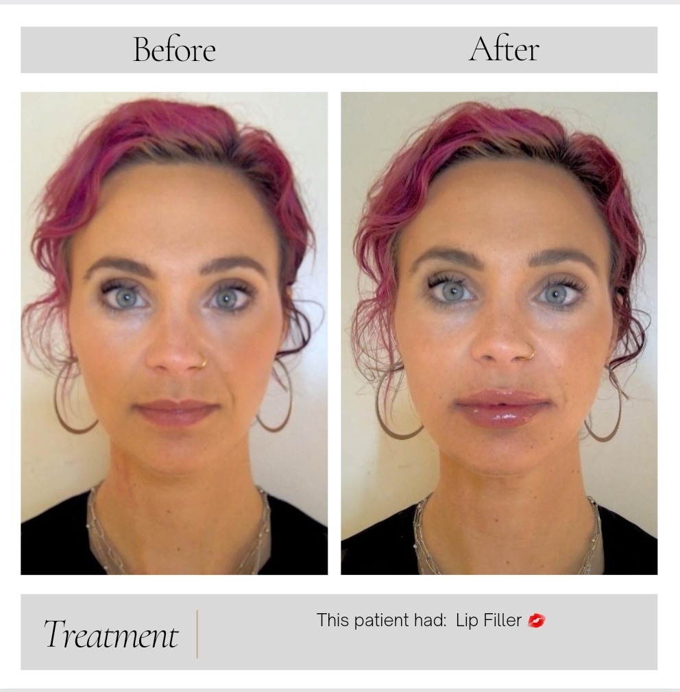 Facial Balancing in Kansas City, MO