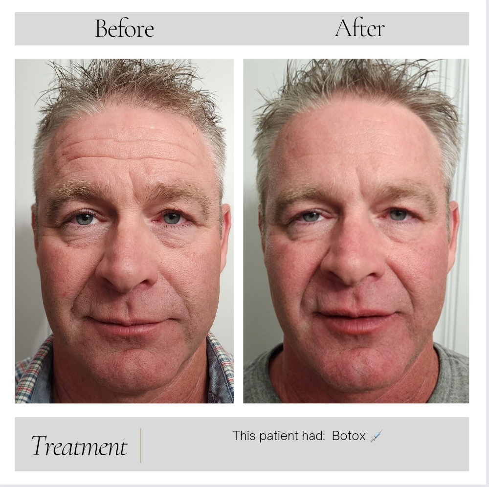 Facial Balancing in Kansas City, MO