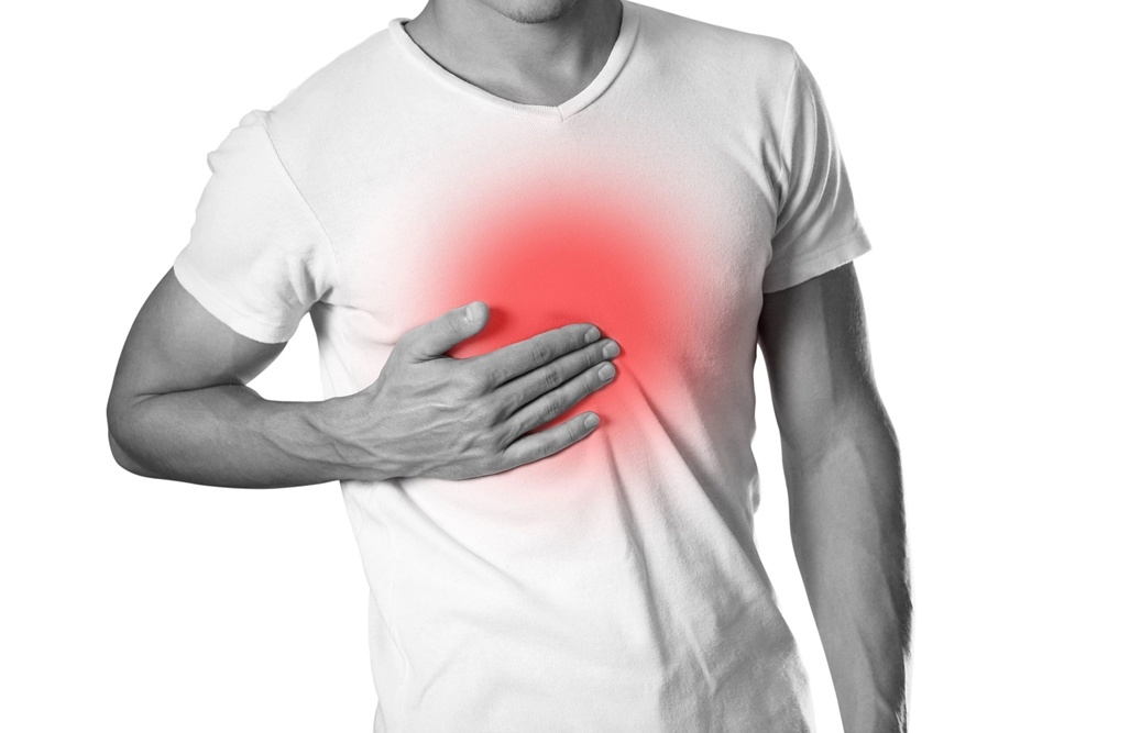 Heartburn and Heart Attack: What’s the Difference?