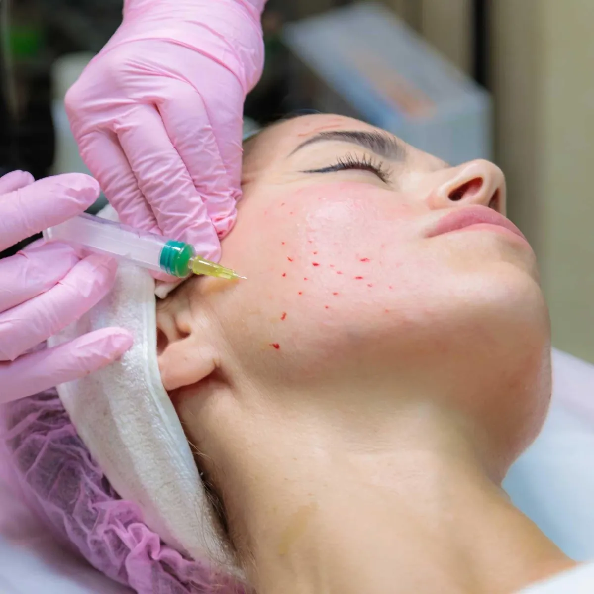 Resultados antes y después de rejuvenecimiento facial en Amado Clinic Miami