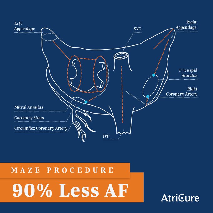 Bright modern operating room with surgeons performing a minimally invasive heart procedure