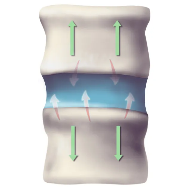 Spinal decompression machine in use on patient’s back
