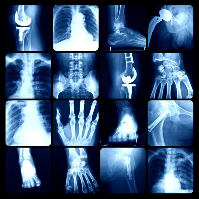 Digital X-ray images of spine displayed for chiropractic assessment