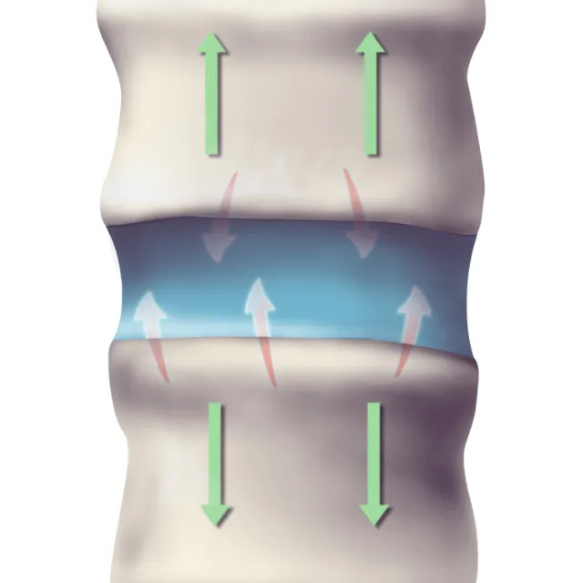 Plano chiropractor performing neck and lower back spinal decompression