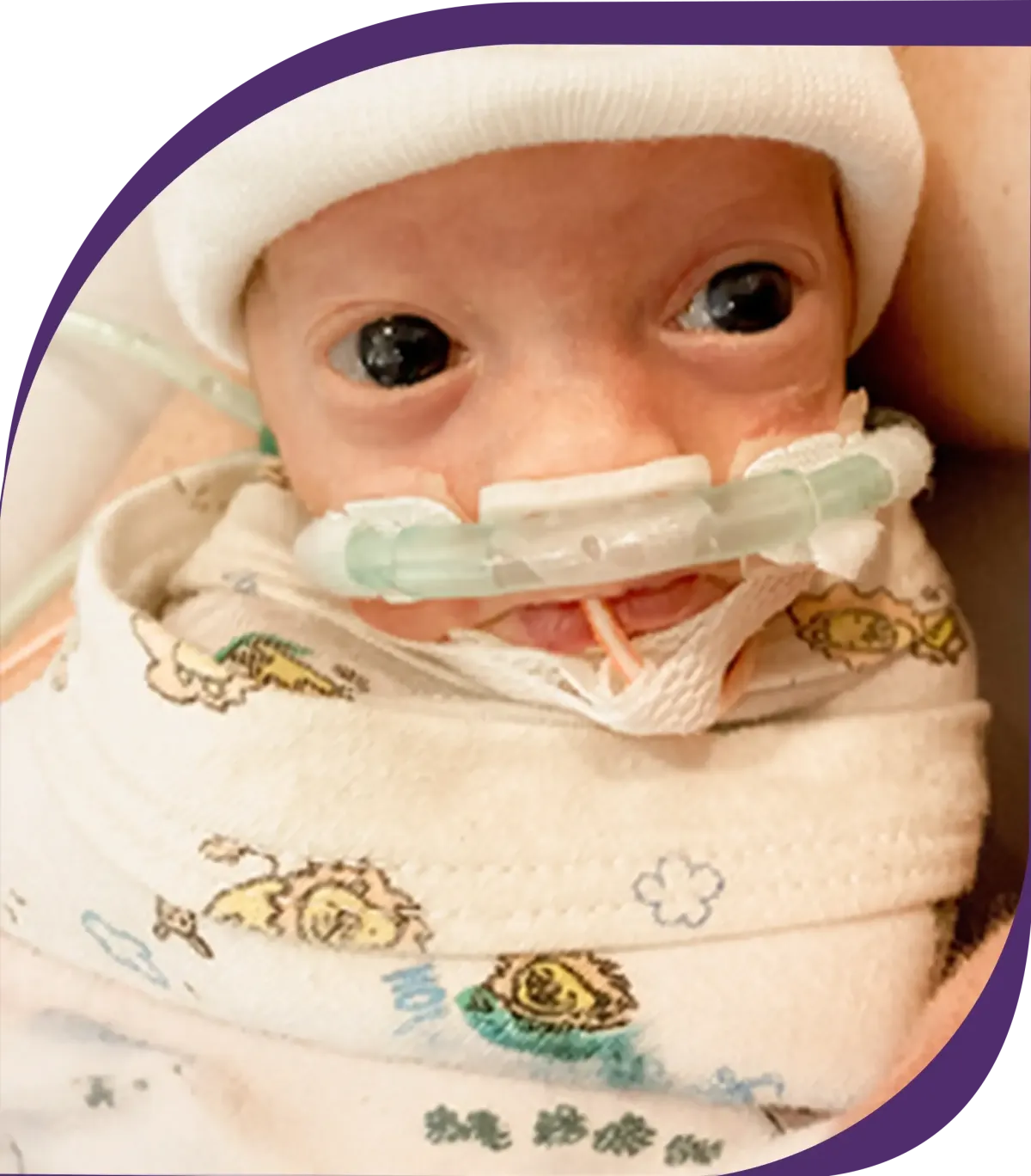 Prolacta Babies Baby Eliza and Baby Octavia in the NICU