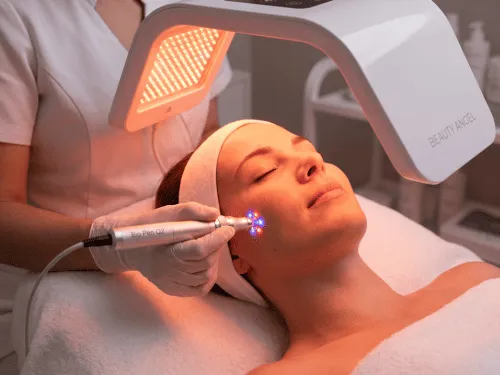 microneedling med beauty angel lysterapi
