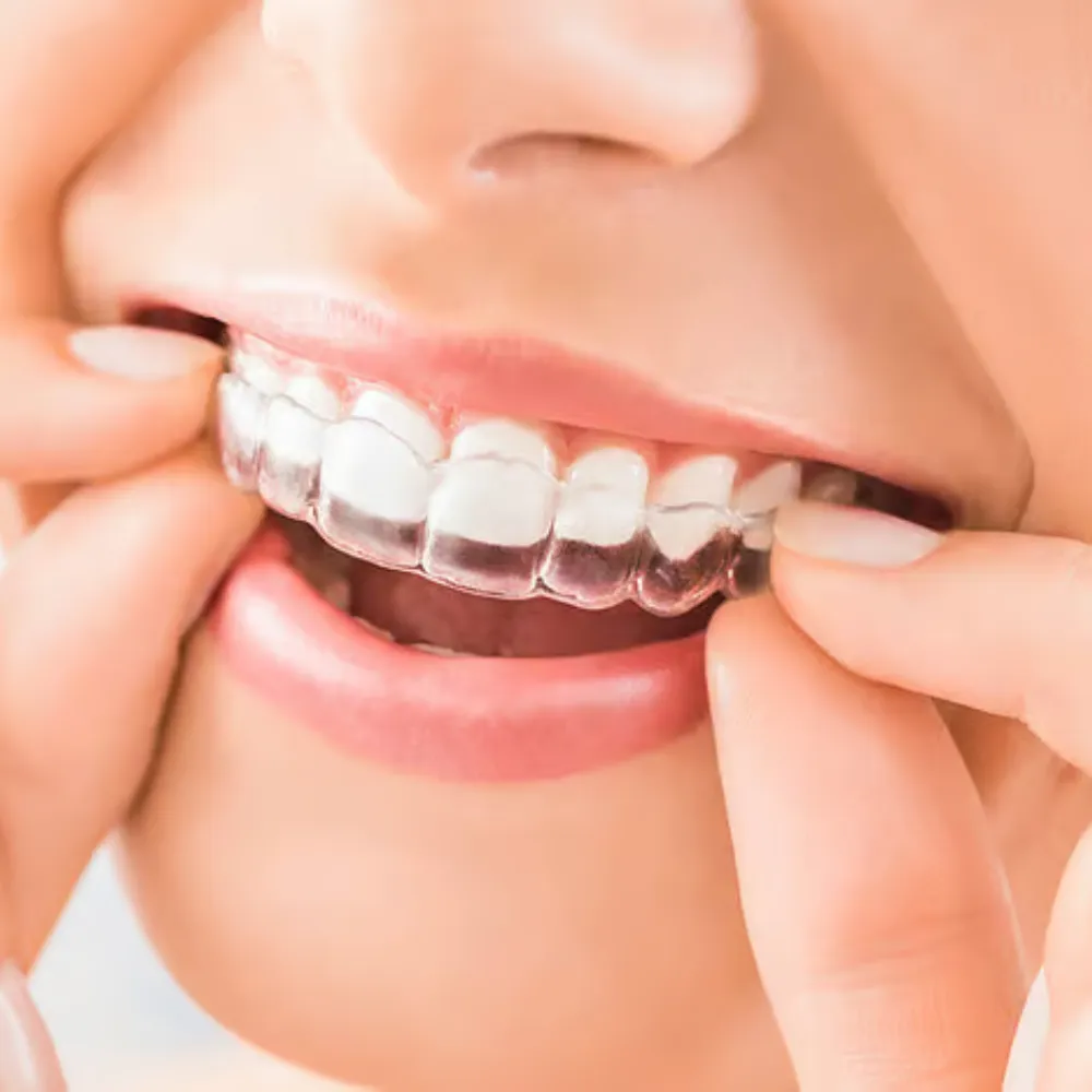 Invisalign