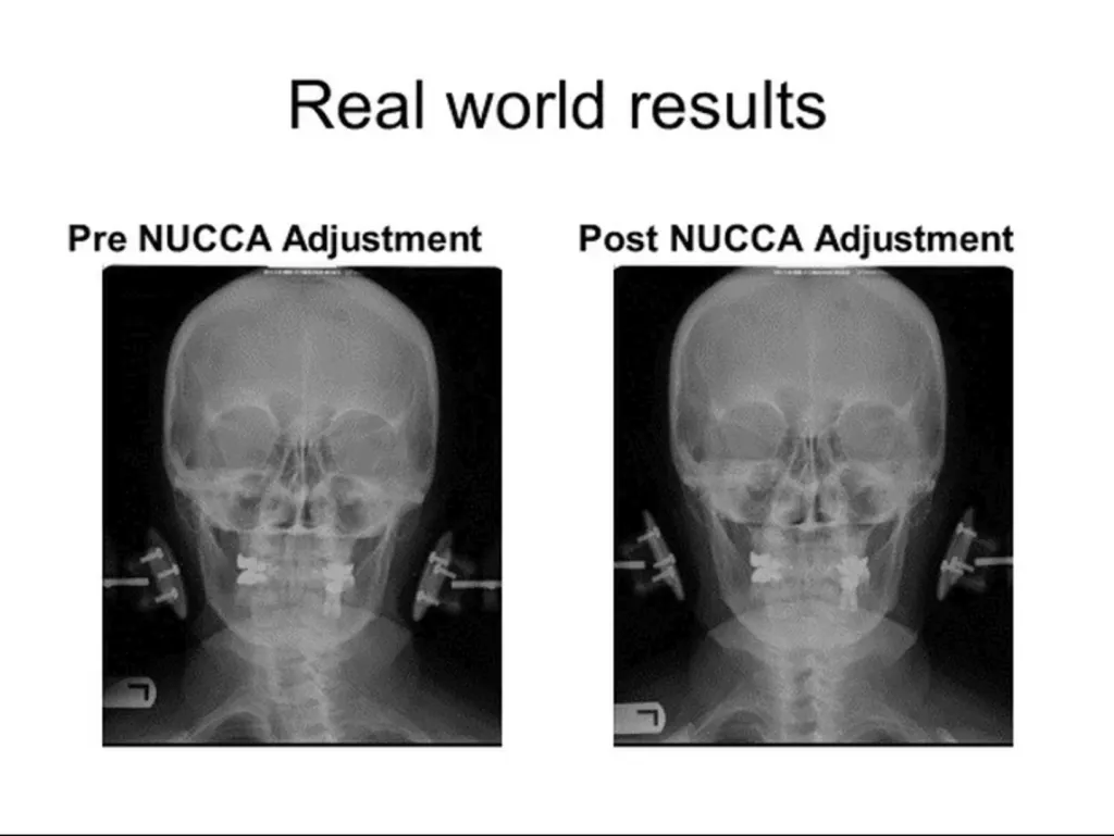 NUCCA doctor test results