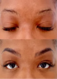 Million Dollar Facial