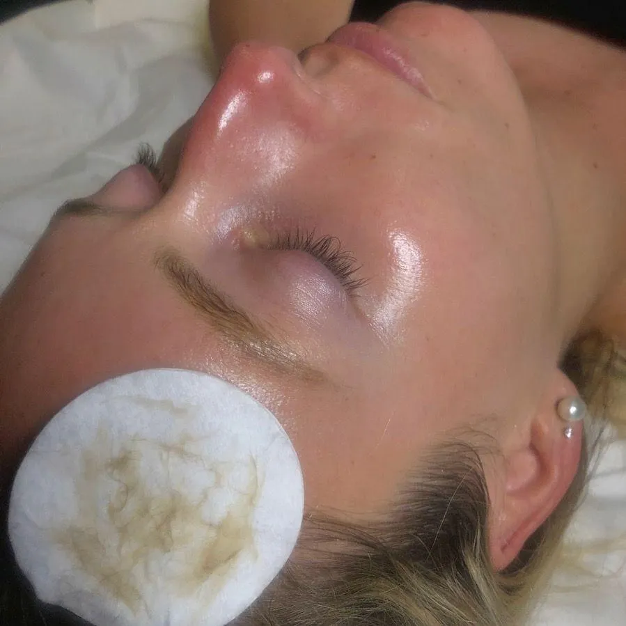Million Dollar Facial