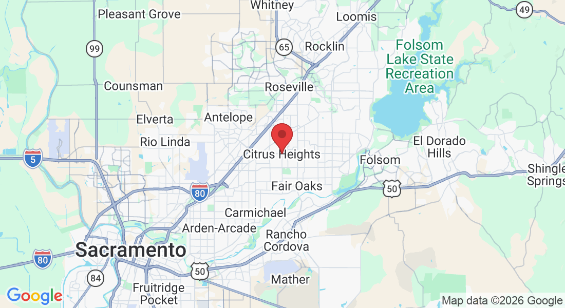 Citrus Heights, CA, USA