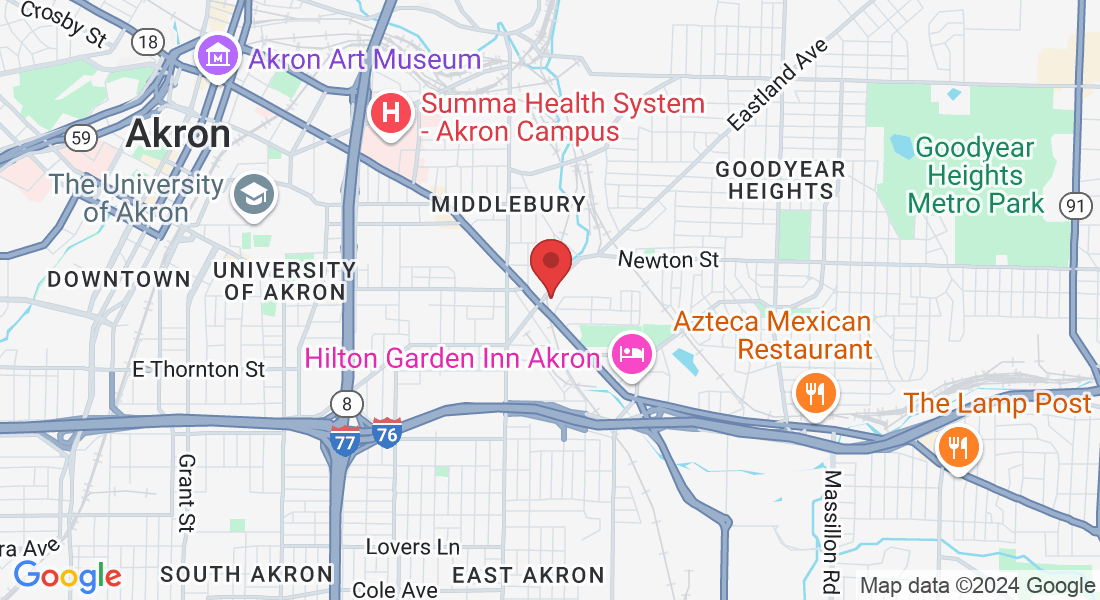 31 N Case Ave, Akron, OH 44305, USA