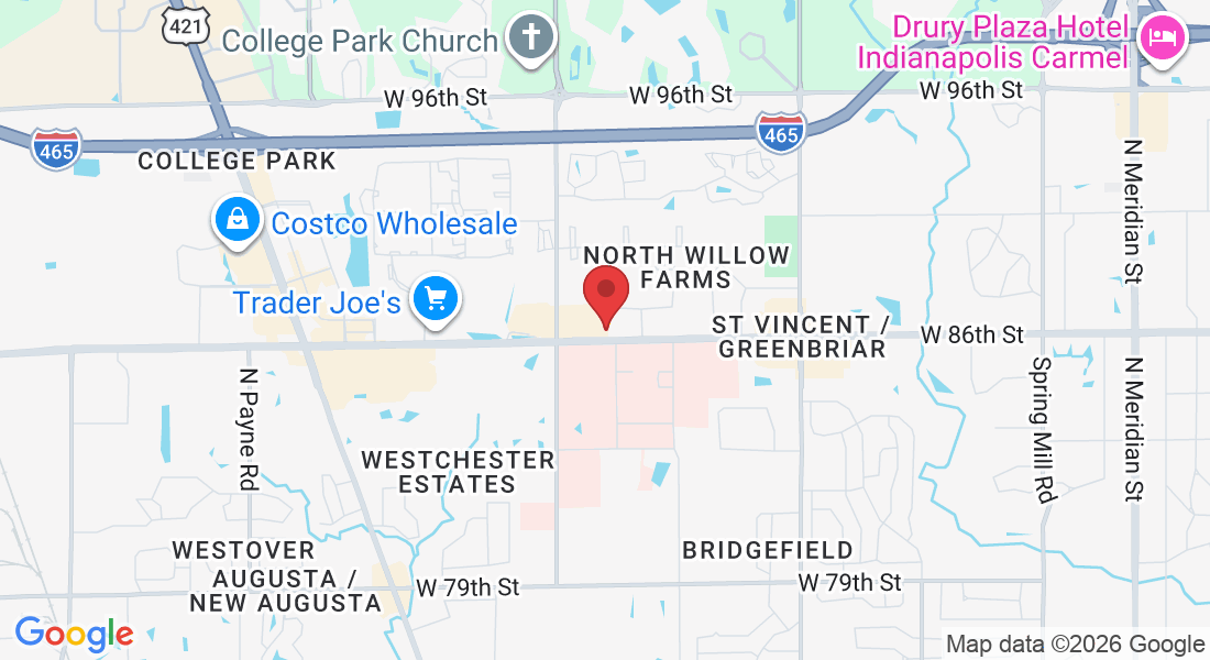 2160 W 86th St, Indianapolis, IN 46260, USA