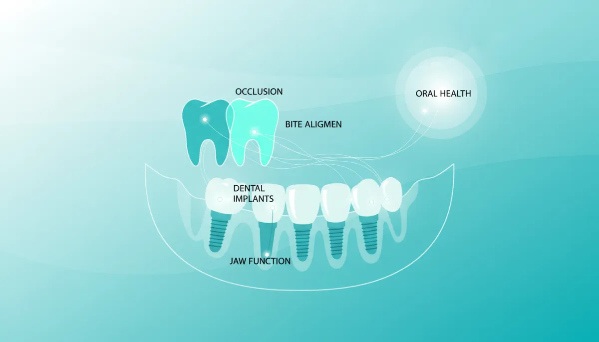 Occlusion & Implants: Key to Lasting Oral Health