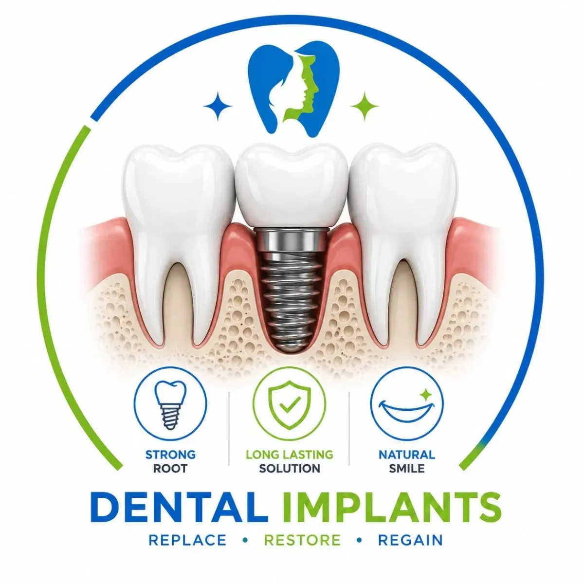 Dental Implants