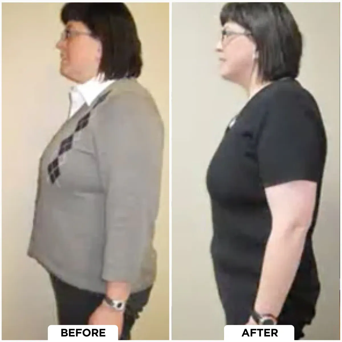 Before and After result 1