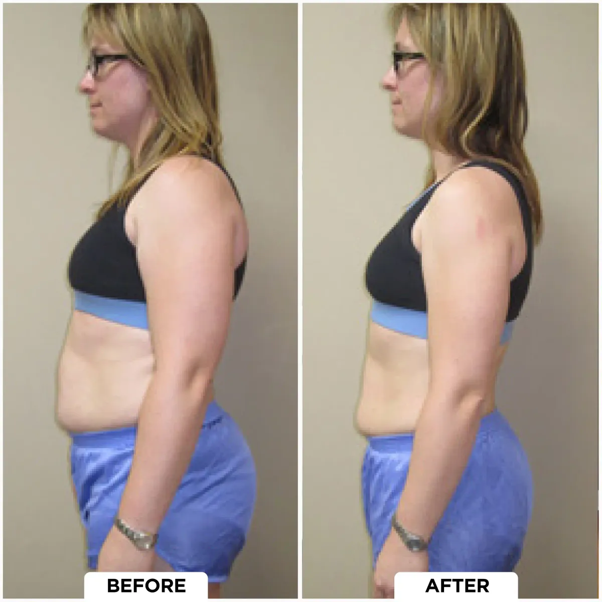 Before and After result 2