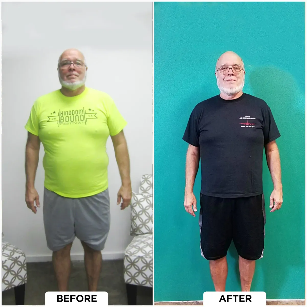 Before and After result 4