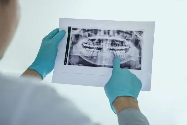How Digital Scans Influence the Final Restoration