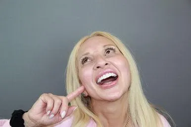 Teeth before and after result 4