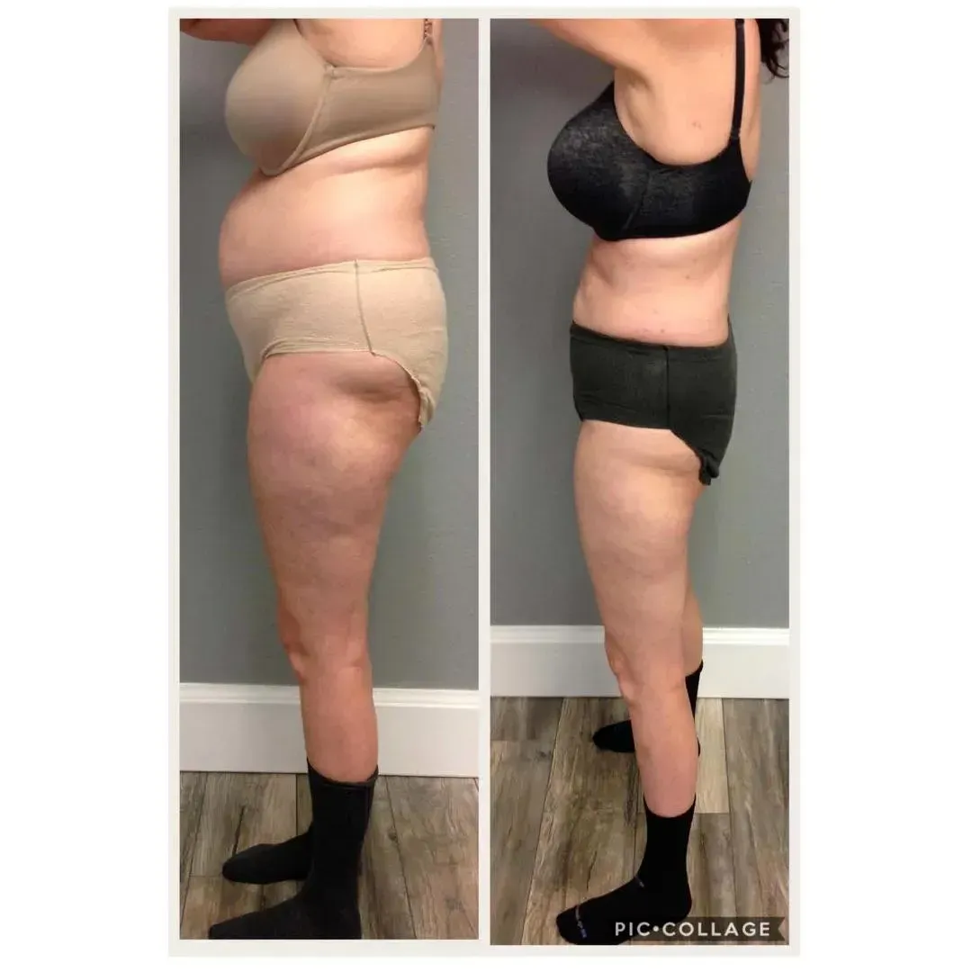 BeforeAfter3
