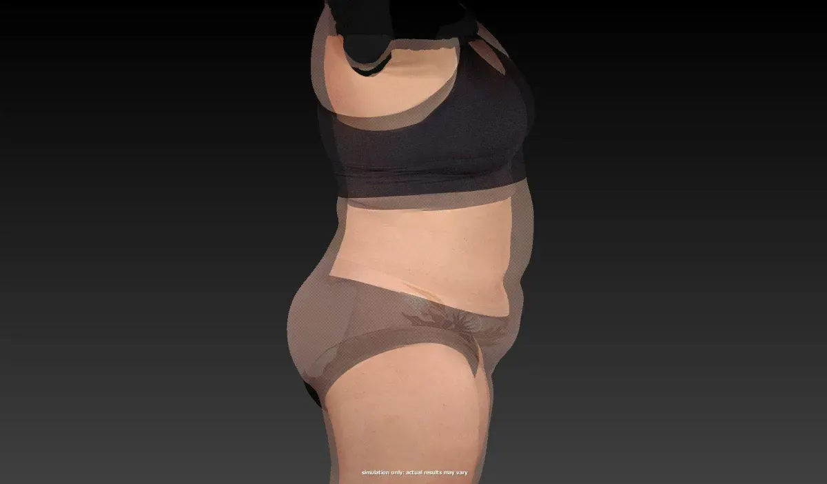 Old Body vs. New Body