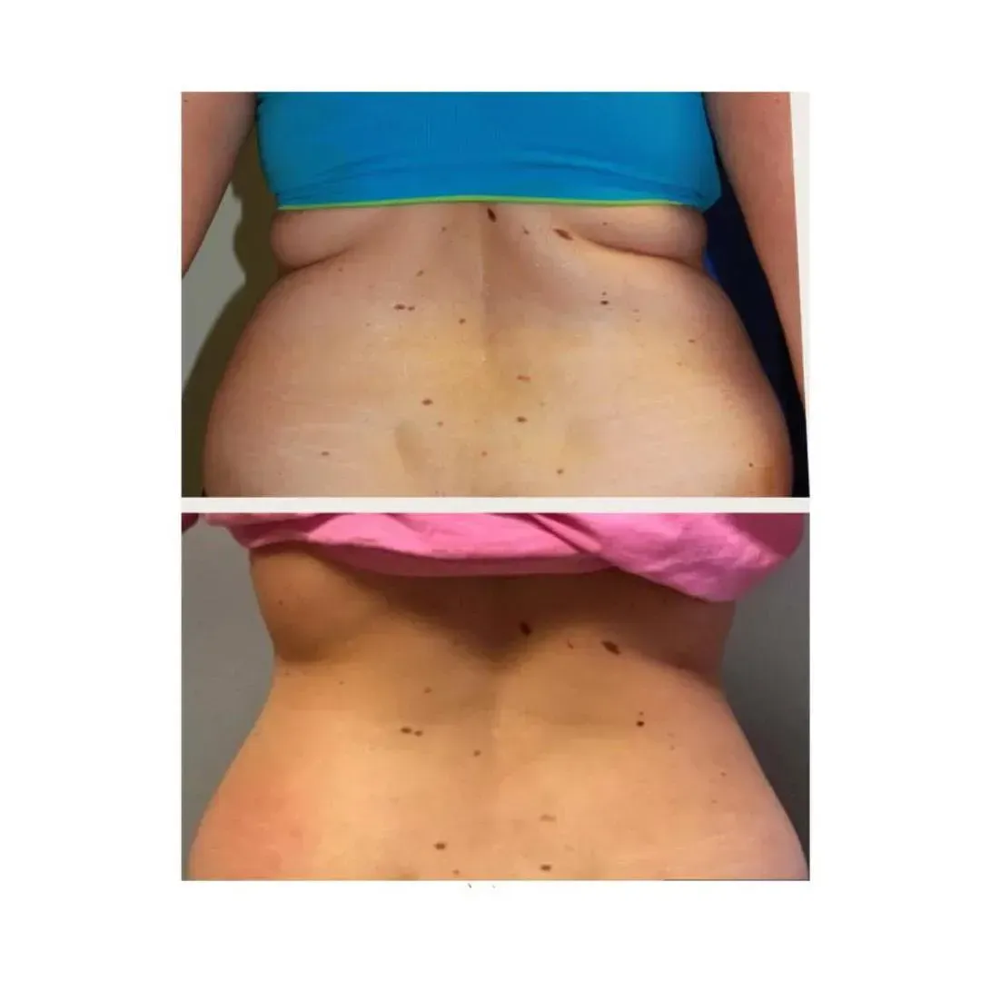 BeforeAfter1