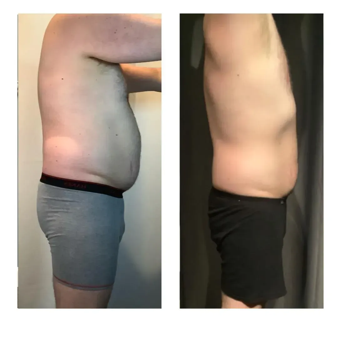 BeforeAfter2