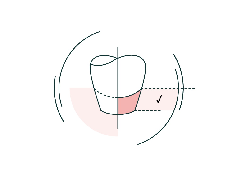 Periodontal plastic surgery