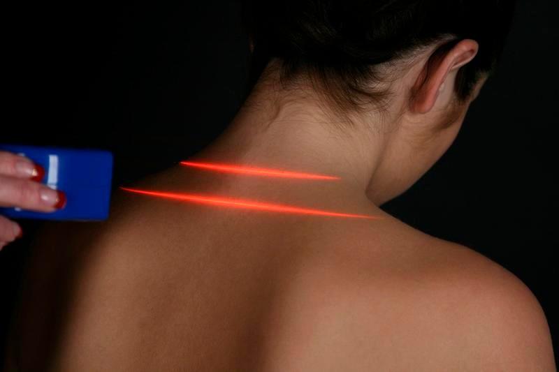 Cold Laser Therapy