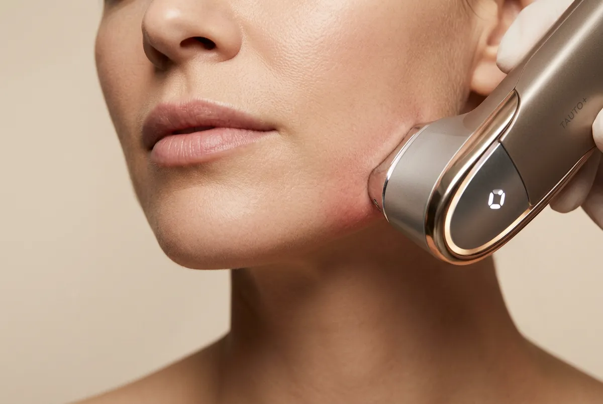 Close-up skin tightening and firming facial aesthetic treatment