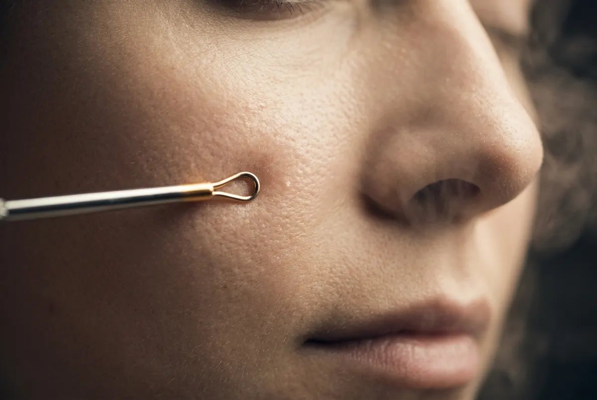 Close-up deep cleansing facial steam and extraction therapy on pores
