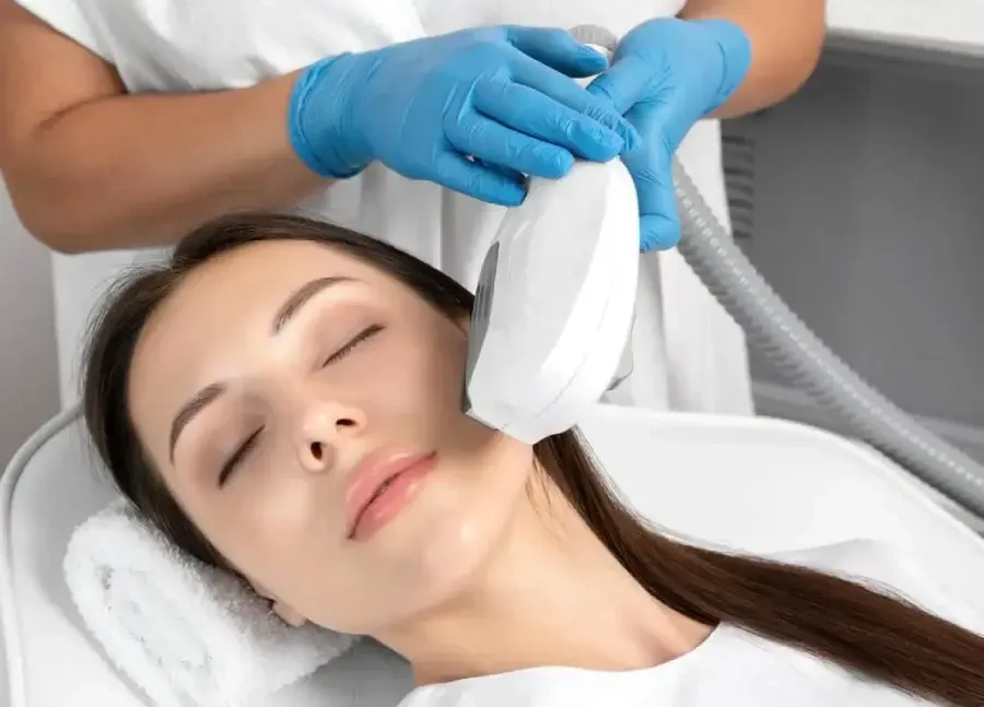 IPL Photofacial service image