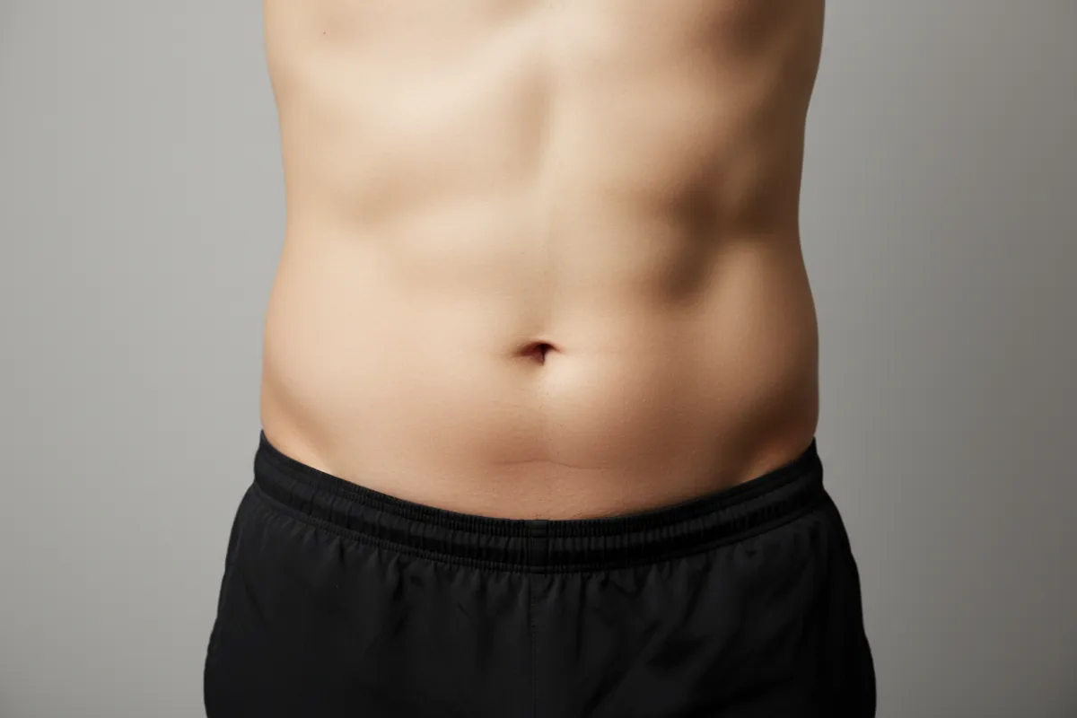 Before photo: frontal waist and lower abdomen showing stubborn fat deposits and lack of definition; clinical framing designed to show measurable baseline for contouring treatment.