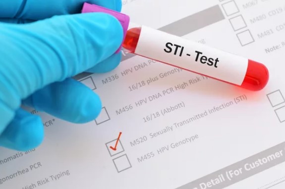 STI Test