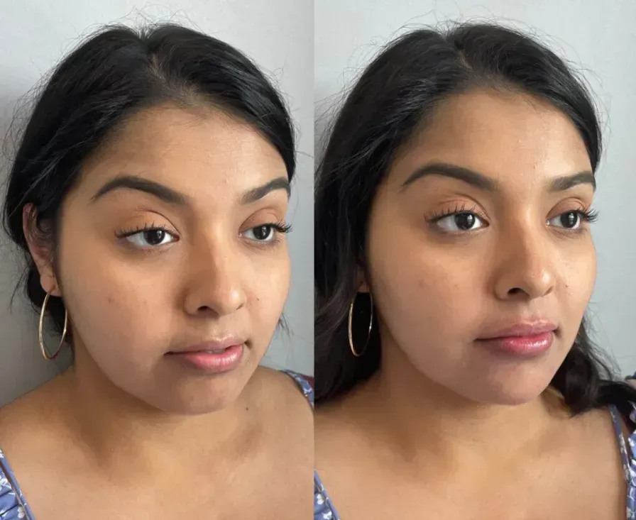 Facial Balancing