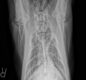Vail Scapula X-ray