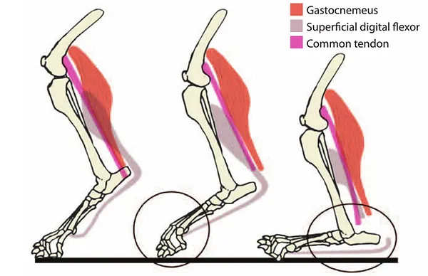 RETURN TO AGILITY AFTER ACHILLES TENDON INJURY