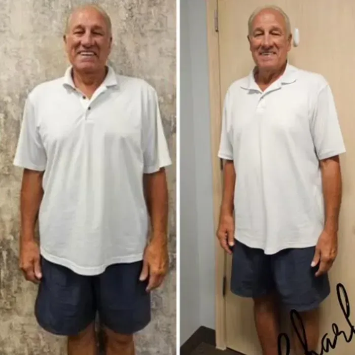 Charles J before and after weight loss