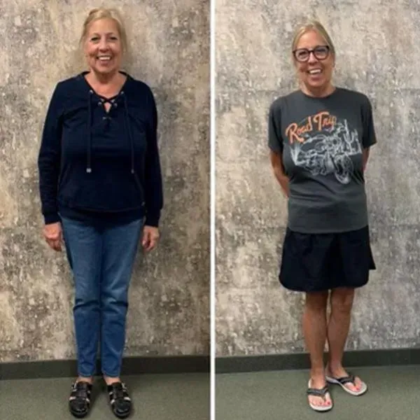 Sandy M before and after weight loss