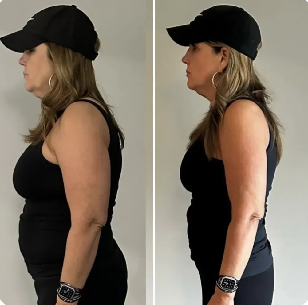 Michelle K before and after weight loss