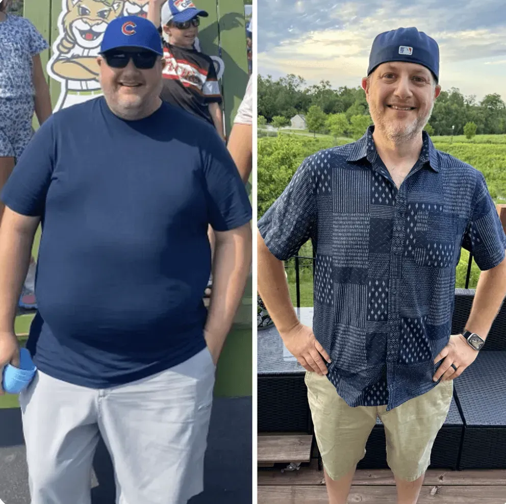 Lou L before and after weight loss